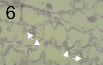 استعمار نسيج الميزوفيل بواسطة خيط فطري بين الخلايا (الأسهم) من فطر Zymoseptoria tritici خلال المرحلة التغذوية الحيوية غير المصحوبة بأعراض من التسبب في المرض.