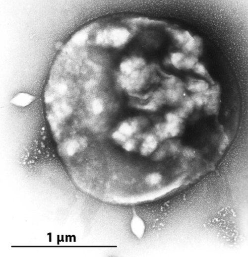 صورة مجهرية إلكترونية لـ Sulfolobus مصاب بفيروس Sulfolobus STSV1.