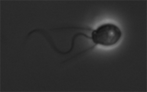 سالبينجويكا (Choanoflagellatea)