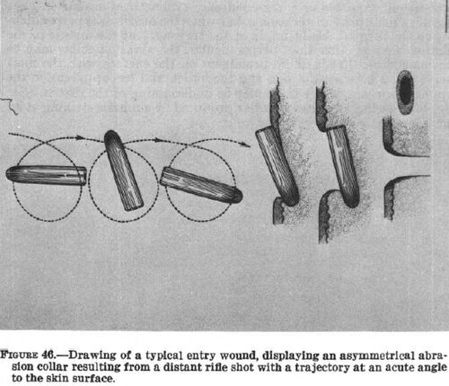 يُظهر رسم توضيحي الرصاصة التي أصابت كينيدي قبل لحظات، وهي تدور وتتقلب قبل أن تدخل جلد كونالي، مما تسبب في جرح دخوله.