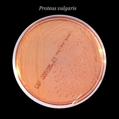 طبق يحتوي على أجار وردي باهت تنمو عليه مستعمرات عديمة اللون تحت نص مكتوب عليه Proteus vulgaris