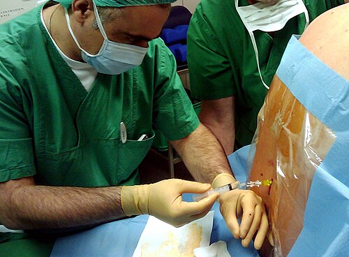 يقوم رجل بحقن سائل شفاف عبر أنبوب في عمود المريض الفقري