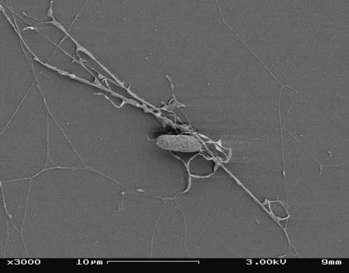 فطر Aplanochytrium sp. تحت المجهر الإلكتروني الماسح