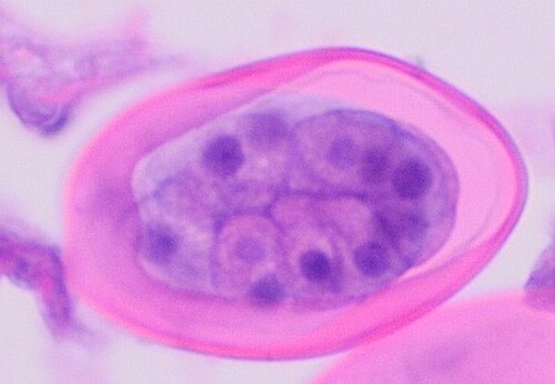 مقطع عرضي لبيضة مبكرة من نوع E. vermicularis، مصبوغة بصبغة الهيماتوكسيلين والإيوسين