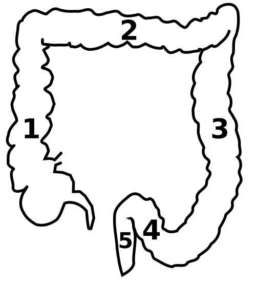 1: القولون الصاعد 2: القولون المستعرض 3: القولون النازل 4: القولون السيني 5: المستقيم