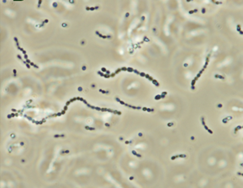 تسببت بكتيريا Streptococcus iniae، وهي بكتيريا موجبة الجرام كروية الشكل، في خسائر في أسماك المياه المالحة والعذبة المستزرعة بلغت 100 مليون دولار أمريكي في عام 1997.