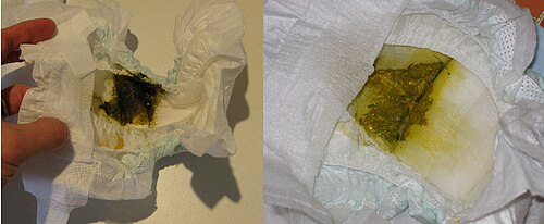 تقارن هذه الصورة مظهر العقي (بعد 48 ساعة من الولادة الطبيعية في موعدها) بمظهر براز نفس الرضيع بعد أسبوع واحد من الرضاعة الطبيعية.