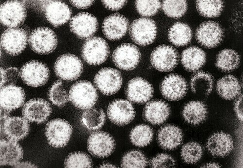 Transmission electron micrograph of rotavirus virions