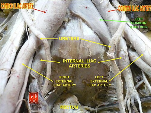 Common iliac arteries