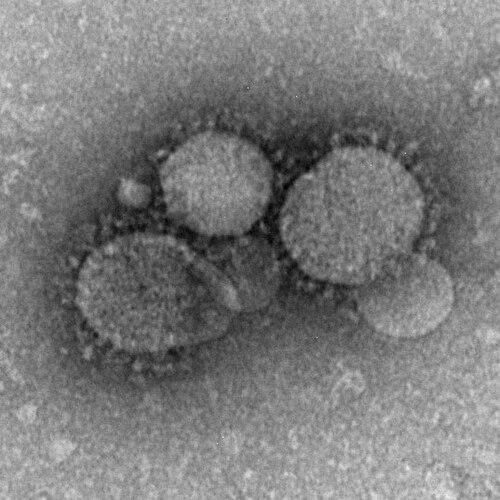 صورة مجهرية إلكترونية لفيروس كورونا المسبب لمتلازمة الشرق الأوسط التنفسية (MERS-CoV).