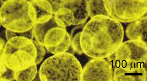 مستعمرات الطحالب Phaeocystis antarctica، وهي من العوالق النباتية المهمة في بحر روس والتي تهيمن على ازدهار أوائل الموسم بعد انحسار الجليد البحري وتصدر كميات كبيرة من الكربون.